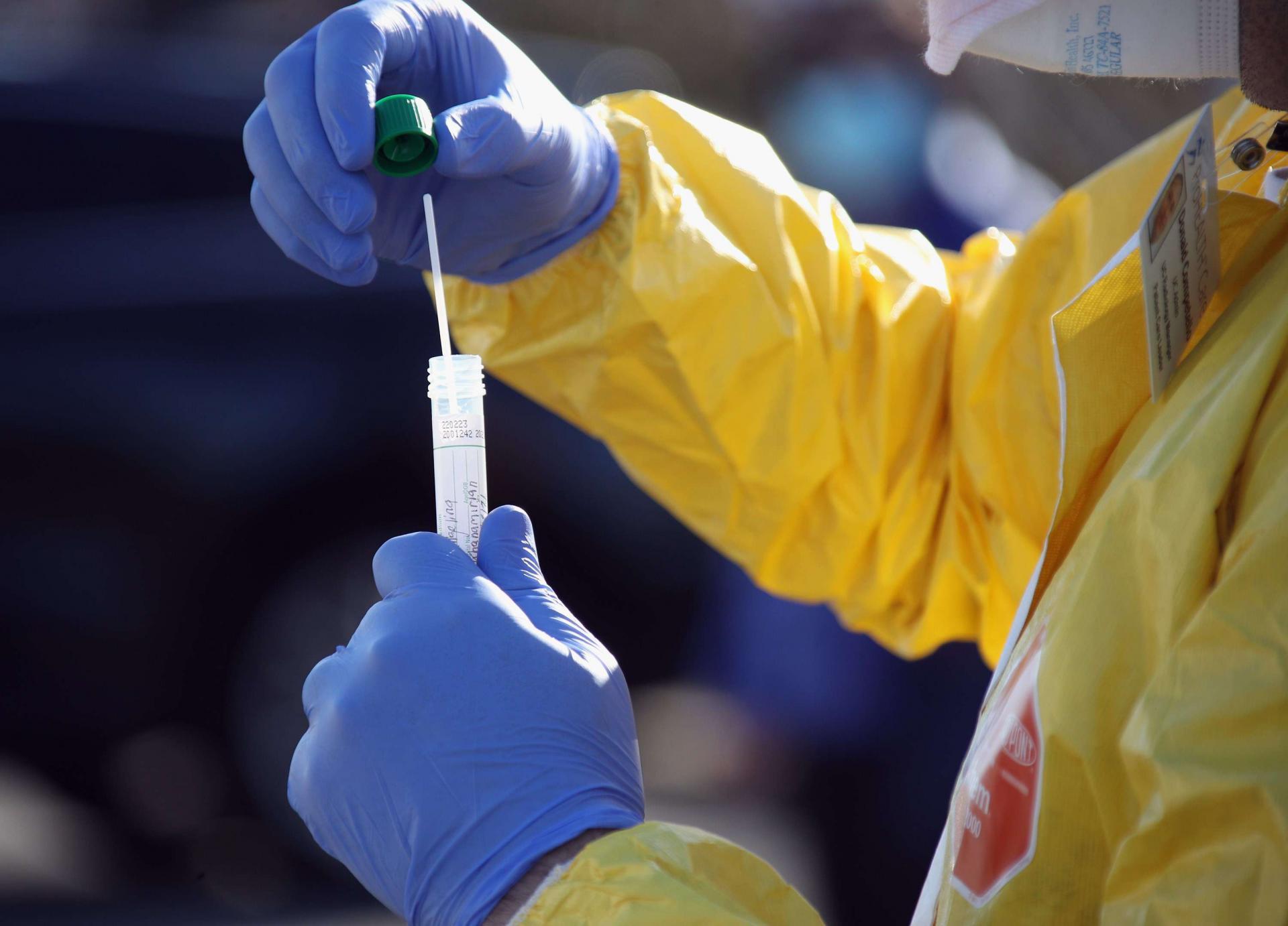 فحص كورونا
