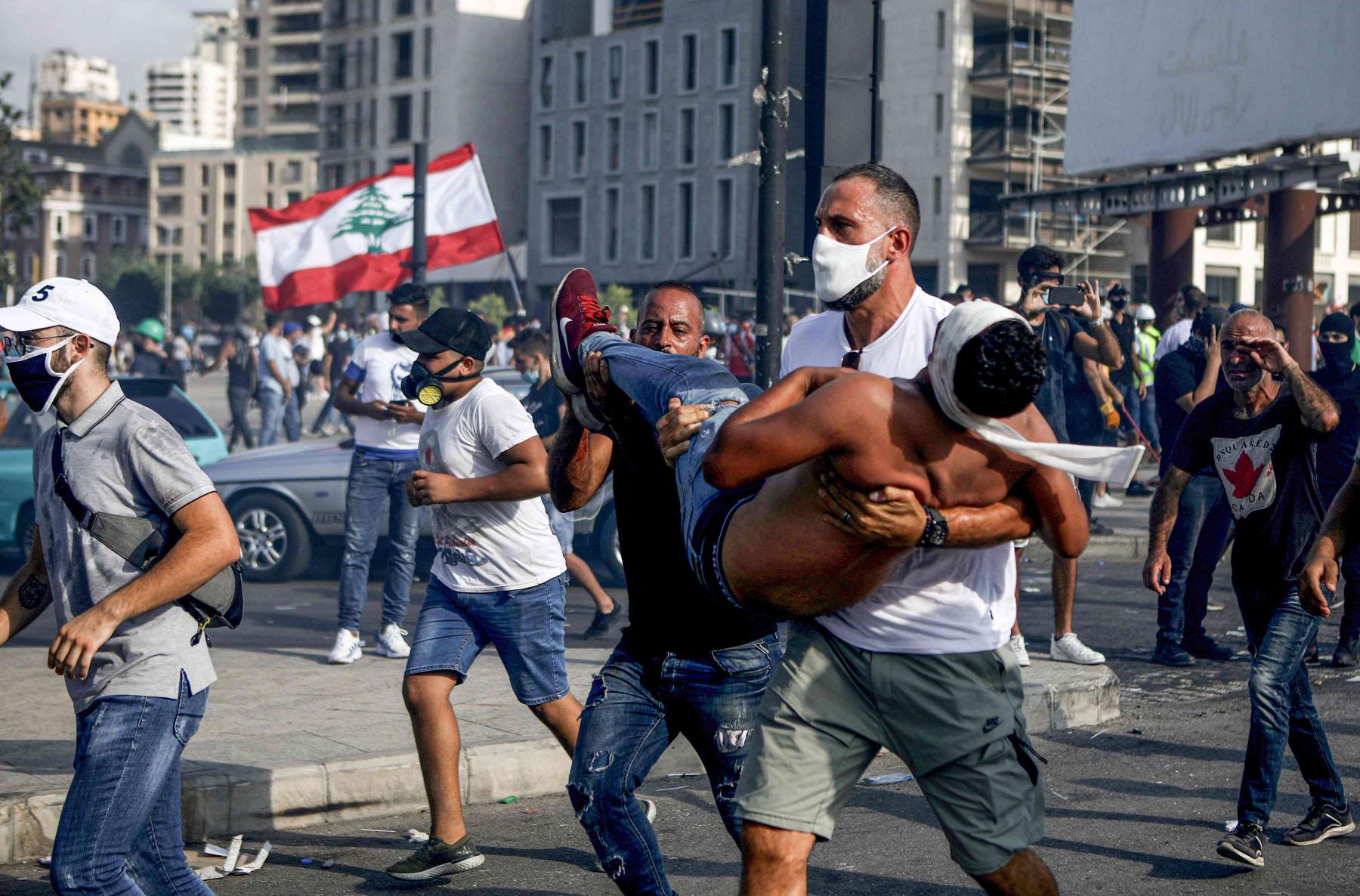 إصابة أكثر من 200 محتج في يوم واحد