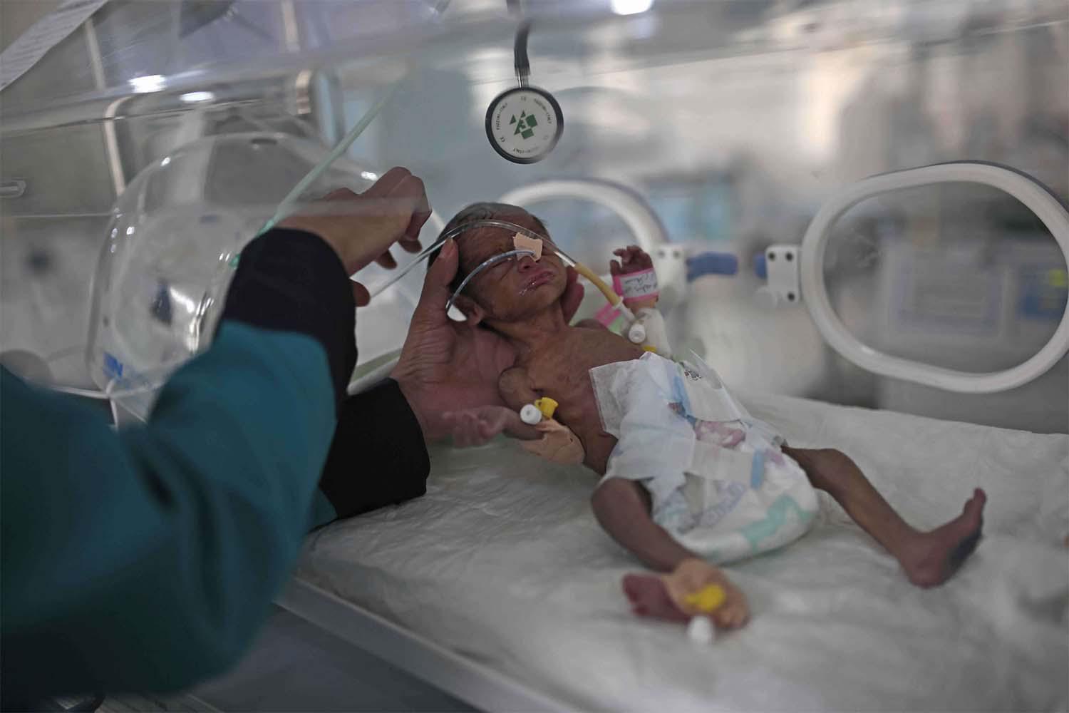 UN United Nations describes Yemen as the world's largest humanitarian crisis