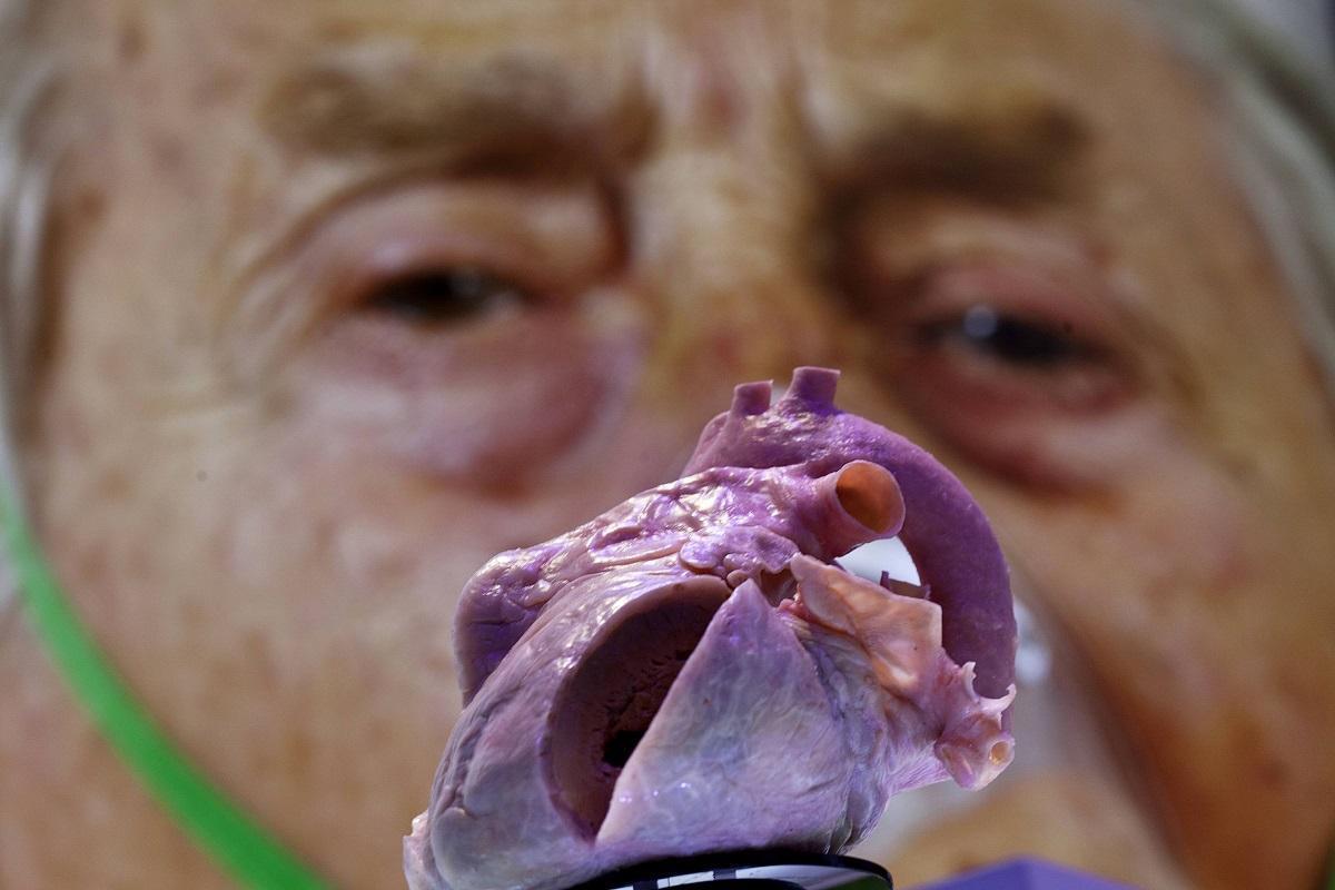 قلب بلاستيكي يظهر أمام ملصق لمريض قلب خلال مؤتمر طبي في هولندا