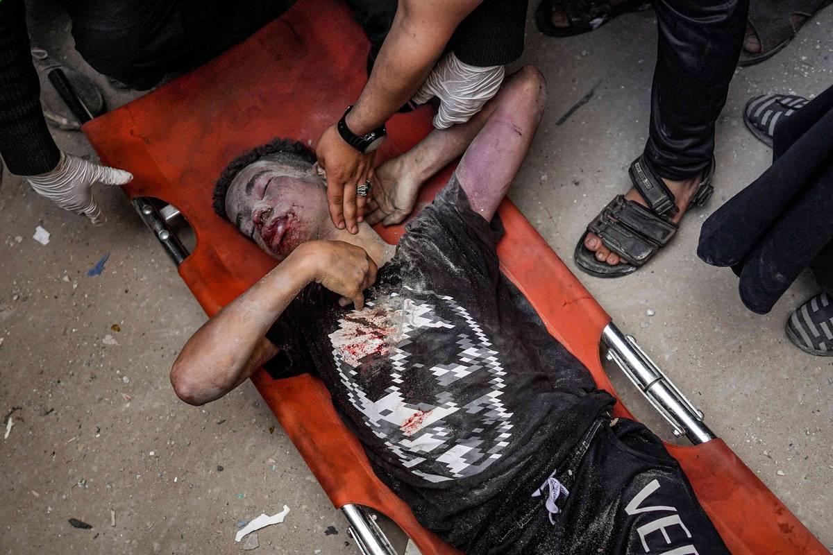 جريح فلسطيني تم انتشاله من تحت انقاض مبنى مدمر في غزة